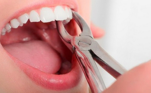 В частной клинике Вологды стоматолог совершил непоправимую ошибку